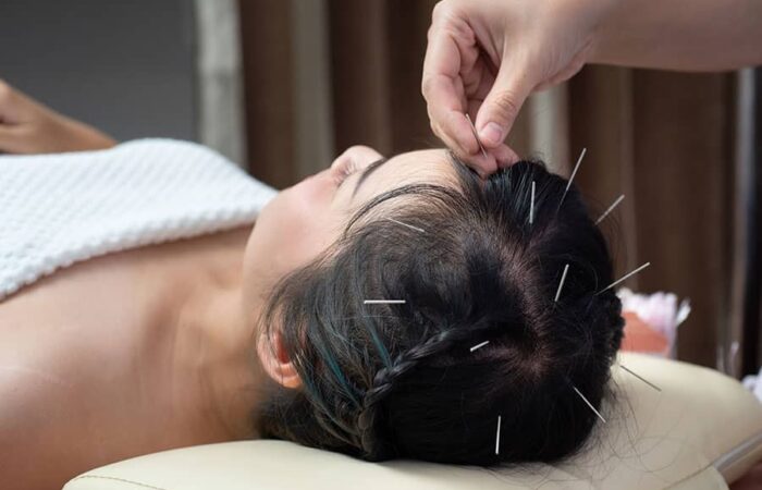 acupuncture programs Admissions
