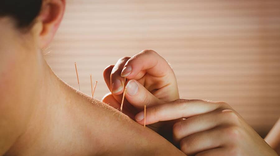 master degree in acupuncture treatment